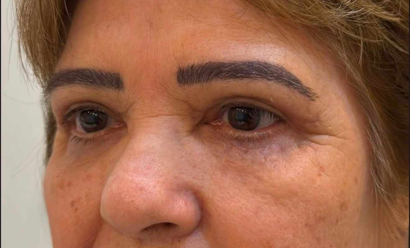 Depois do procedimento: fotografia enviada pela clínica.
